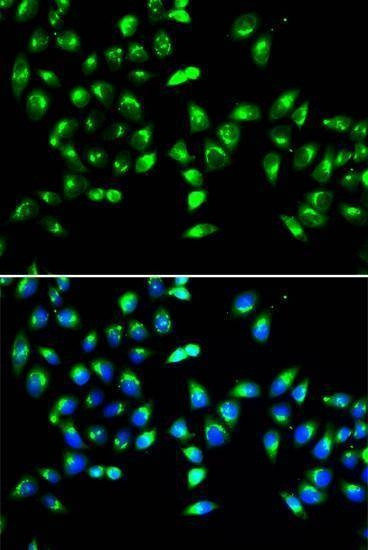 Anti-GALNT2 Antibody