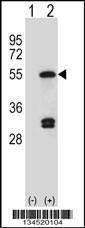 Anti-FDFT1 (C-term) Antibody
