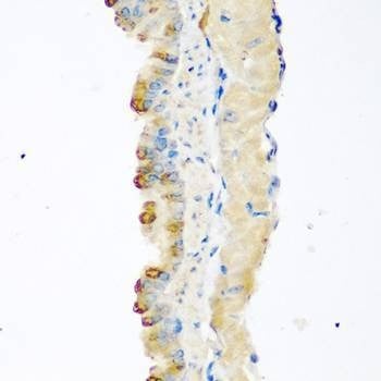 Anti-MSTN Antibody