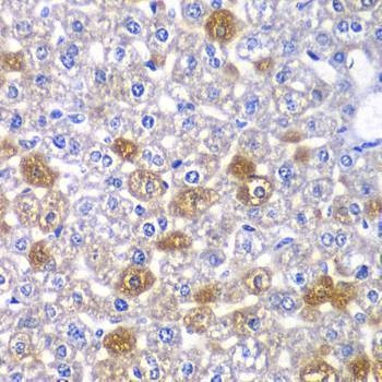 Anti-MYO1C Antibody