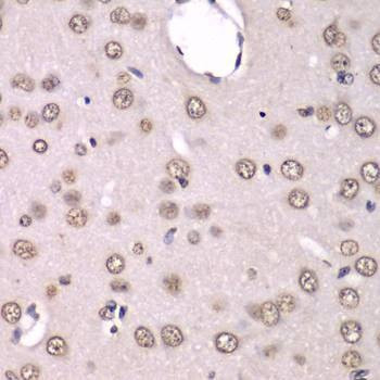Anti-HNRNPM Antibody