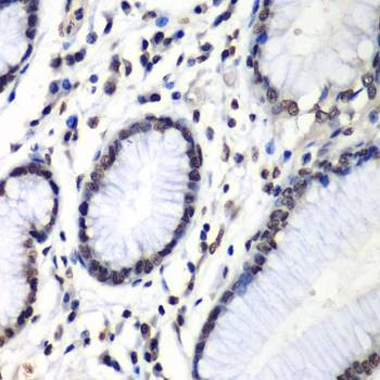 Anti-HNRNPM Antibody
