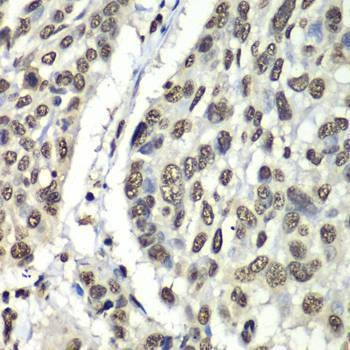 Anti-HNRNPM Antibody