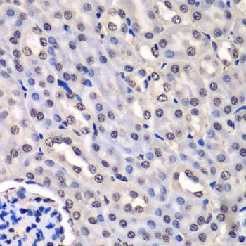 Anti-HNRNPM Antibody
