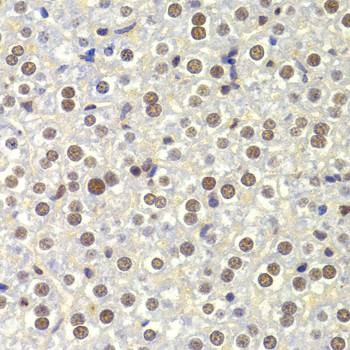 Anti-NASP Antibody