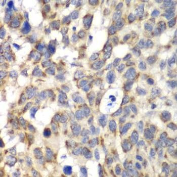 Anti-PARN Antibody