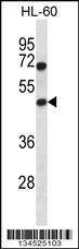 Anti-HAT1 (N-term) Antibody