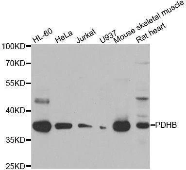 Anti-PDHB Antibody