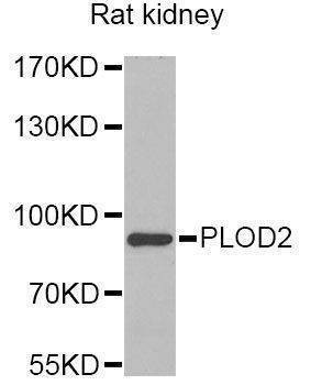 Anti-PLOD2 Antibody