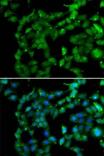 Anti-PRKAB2 Antibody