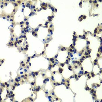 Anti-PSMD13 Antibody