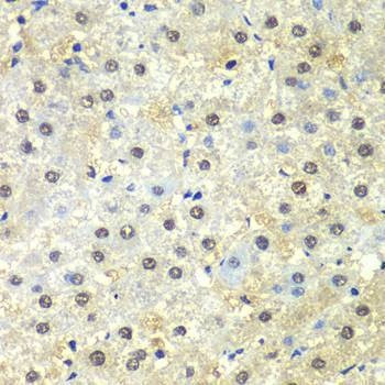 Anti-PSMD13 Antibody