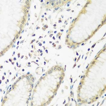 Anti-PYCR1 Antibody