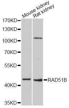 Anti-RAD51B Antibody