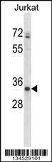 Anti-ART3 (C-term) Antibody