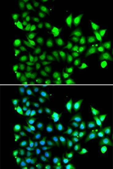 Anti-SNRPD2 Antibody