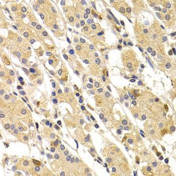 Anti-TNNI3 Antibody