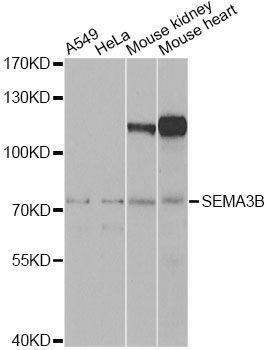 Anti-SEMA3B Antibody