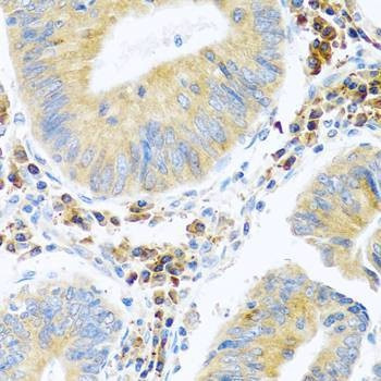 Anti-MANF Antibody