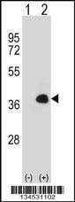 Anti-MEOX1 (Center) Antibody