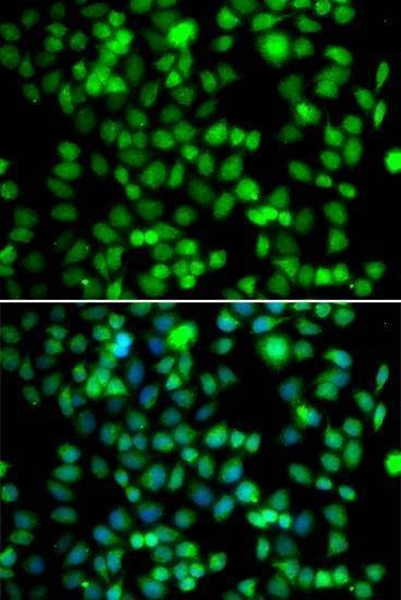 Anti-FKBP6 Antibody