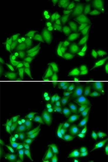 Anti-COPS3 Antibody