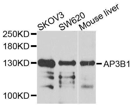 Anti-AP3B1 Antibody