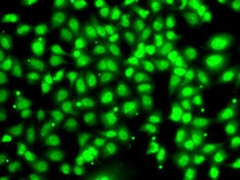 Anti-COPS2 Antibody