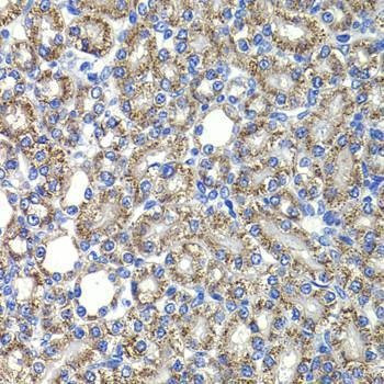 Anti-COPS2 Antibody