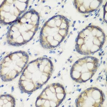 Anti-TGM5 Antibody