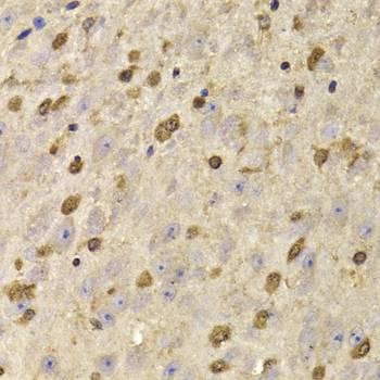 Anti-QKI Antibody