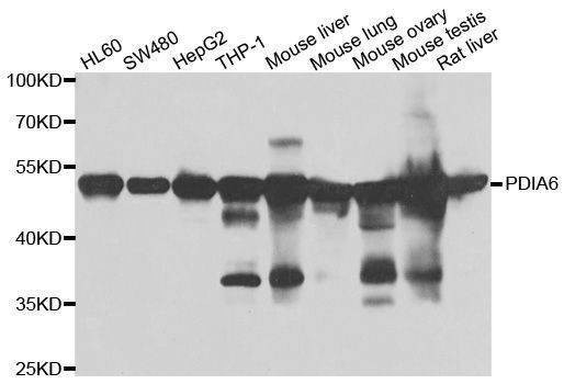 Anti-PDIA6 Antibody