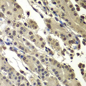Anti-SUB1 Antibody
