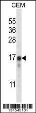 Anti-FREQ (N-term) Antibody