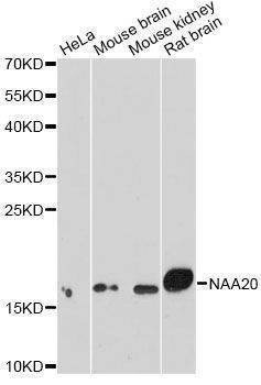 Anti-NAA20 Antibody