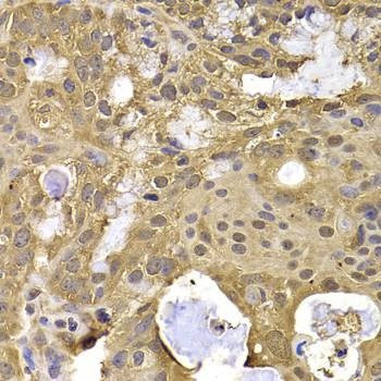 Anti-NAA20 Antibody