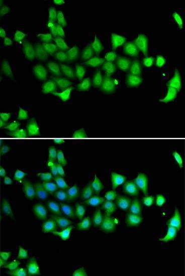 Anti-HSPA14 Antibody