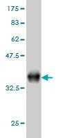 Anti-COL14A1 Antibody