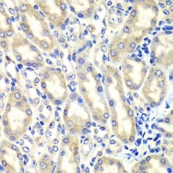 Anti-PTGES2 Antibody
