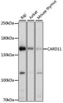 Anti-CARD11 Antibody