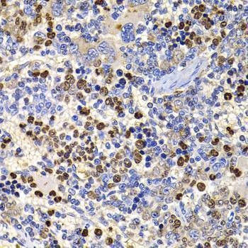 Anti-UBASH3B Antibody