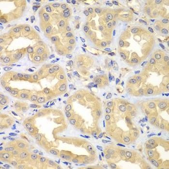 Anti-ELMO3 Antibody