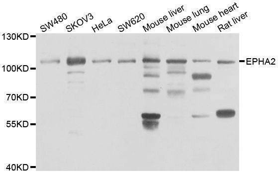 Anti-EPHA2 Antibody
