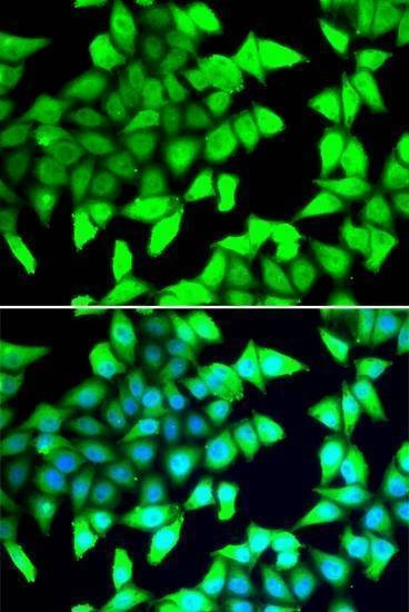 Anti-HDAC5 Antibody