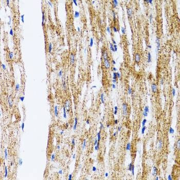 Anti-MAP1LC3B Antibody