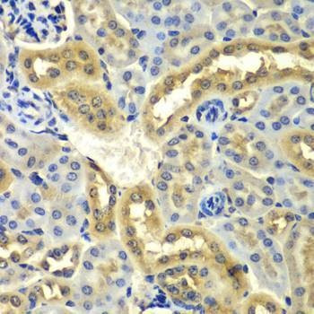 Anti-SYNCRIP Antibody
