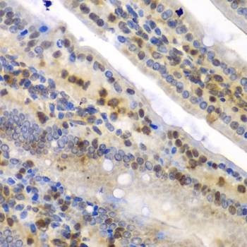 Anti-SYNCRIP Antibody