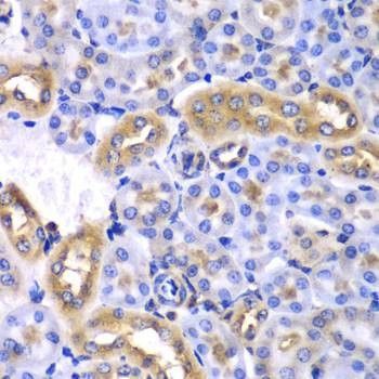 Anti-SYNCRIP Antibody
