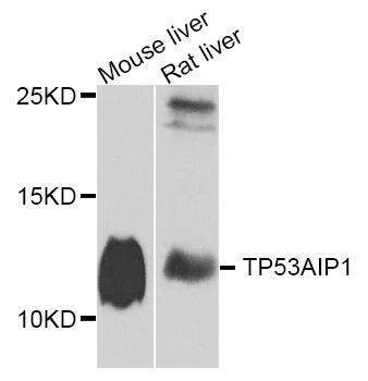 Anti-TP53AIP1 Antibody