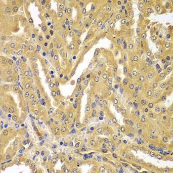 Anti-UBE2Z Antibody